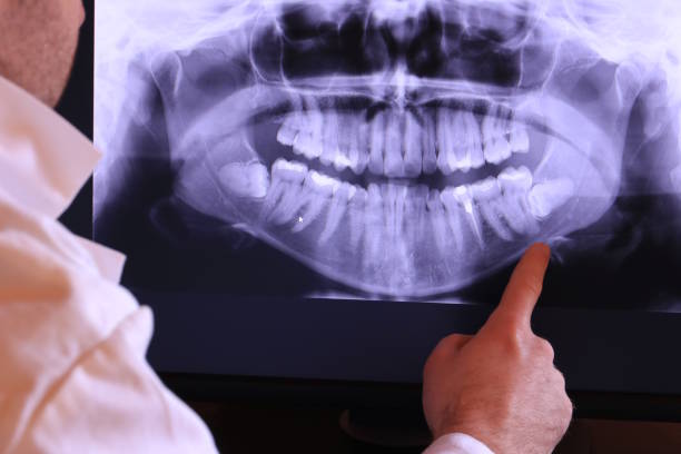 Best Pediatric Emergency Dentist in Nephi, UT