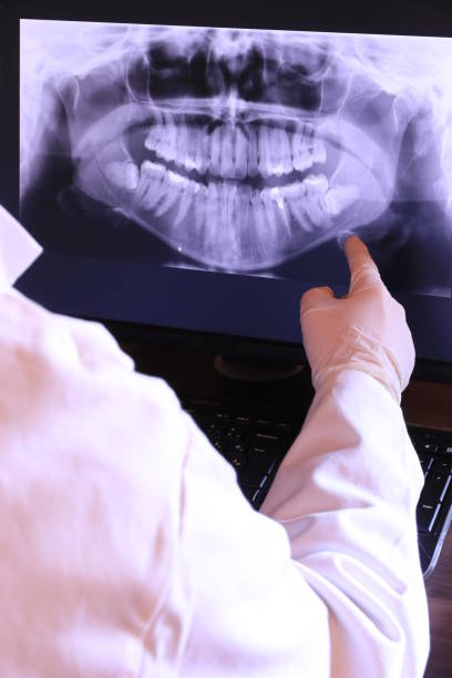 Best Emergency Tooth Extraction in Nephi, UT