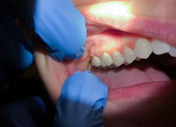 Professional Emergency Dentist in UT